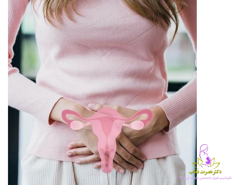 تشخیص تنبلی تخمدان